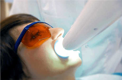 Understanding the Causes of Teeth Sensitivity Gillingham