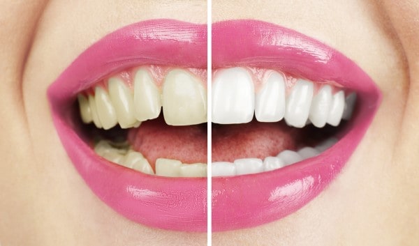What Early Signs of Oral Cancer Should You Never Ignore Gillingham?