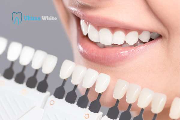 How to Maximise the Results of Your Laser Teeth Whitening Treatment Gillingham