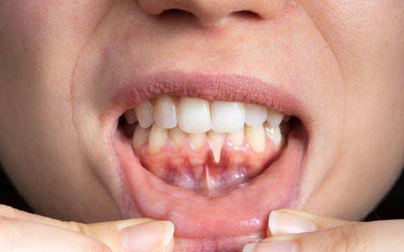 Final Thoughts: Building Lifelong Enamel Protection Habits Gillingham