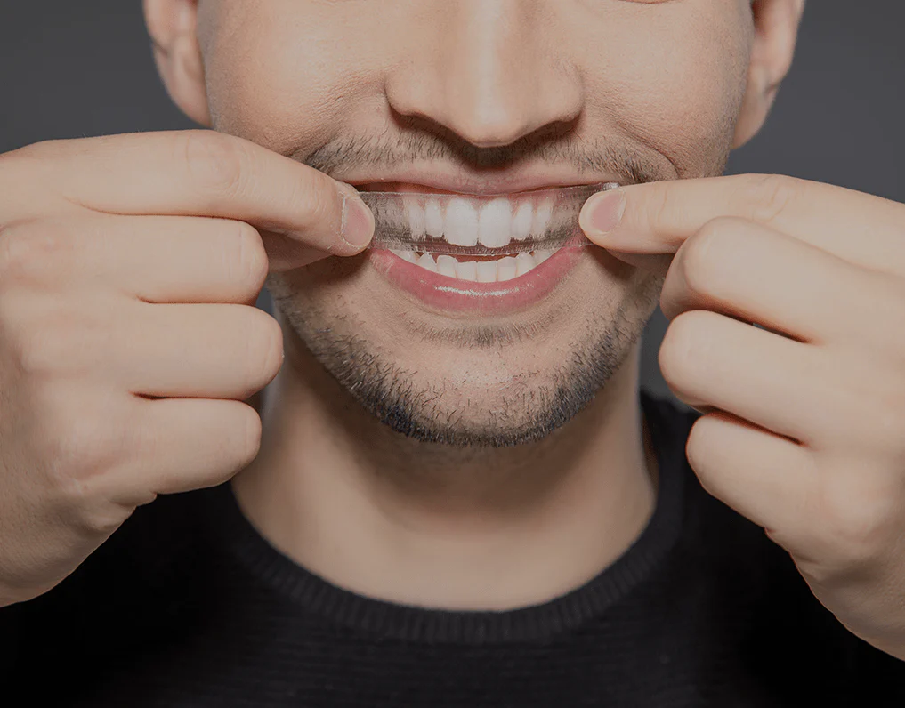 How Are Invisible Aligners Changing Orthodontic Treatments Gillingham?