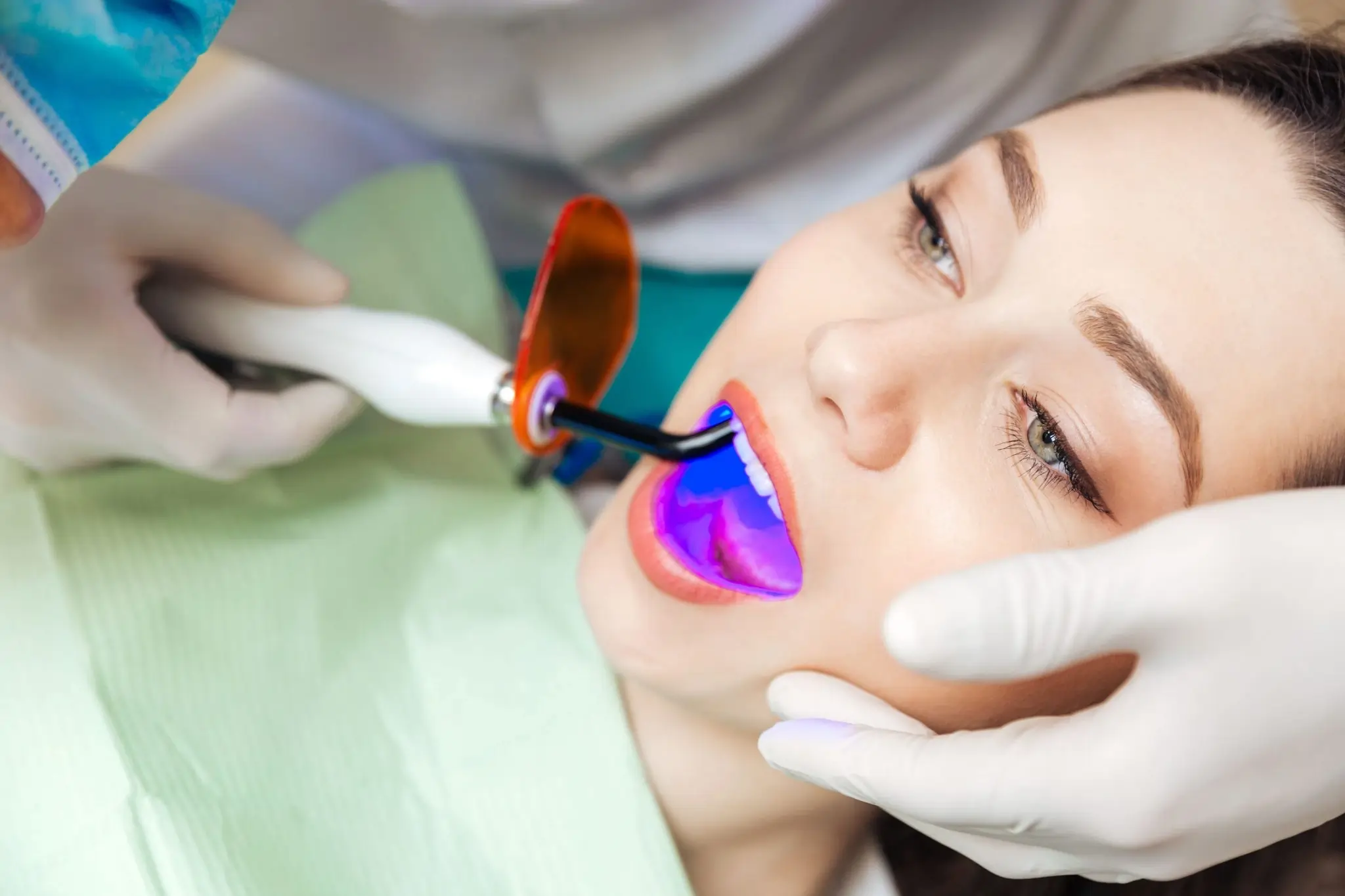 Common Risks of Whitening Without Expert Dental Guidance Gillingham