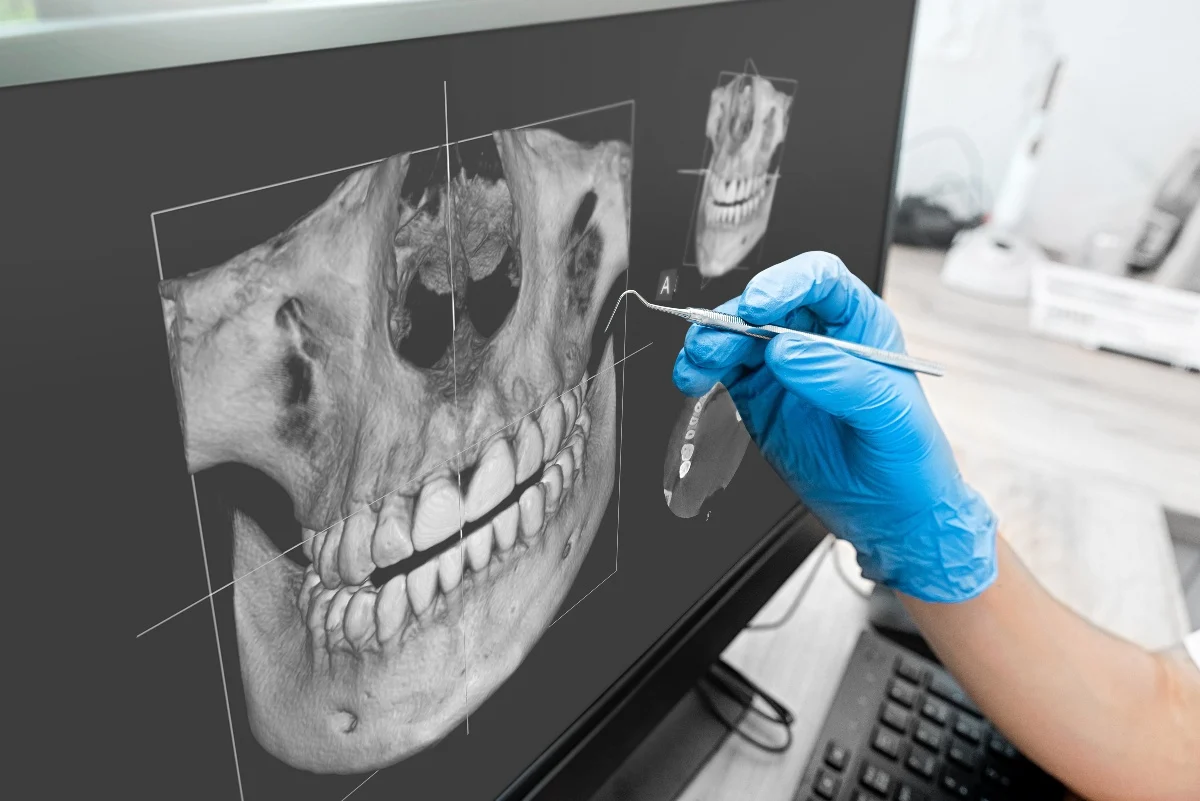 Key Benefits of 3D Printing for Patients and Dentists Gillingham