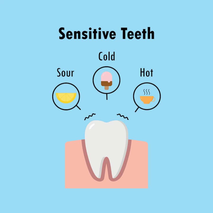 Why Do Teeth Become Sensitive After Whitening Treatments Gillingham?