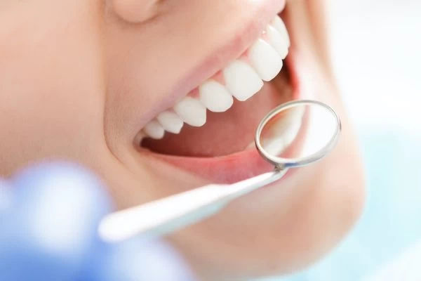How to Maintain Your Whiter Smile After Treatment Gillingham