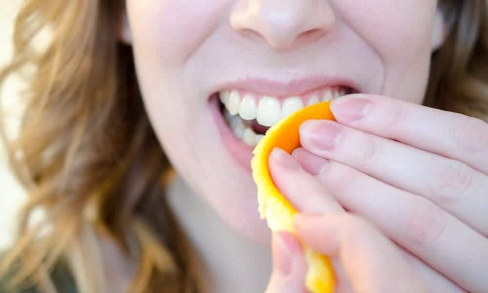 Signs Your Teeth Are Being Damaged by Acid Gillingham