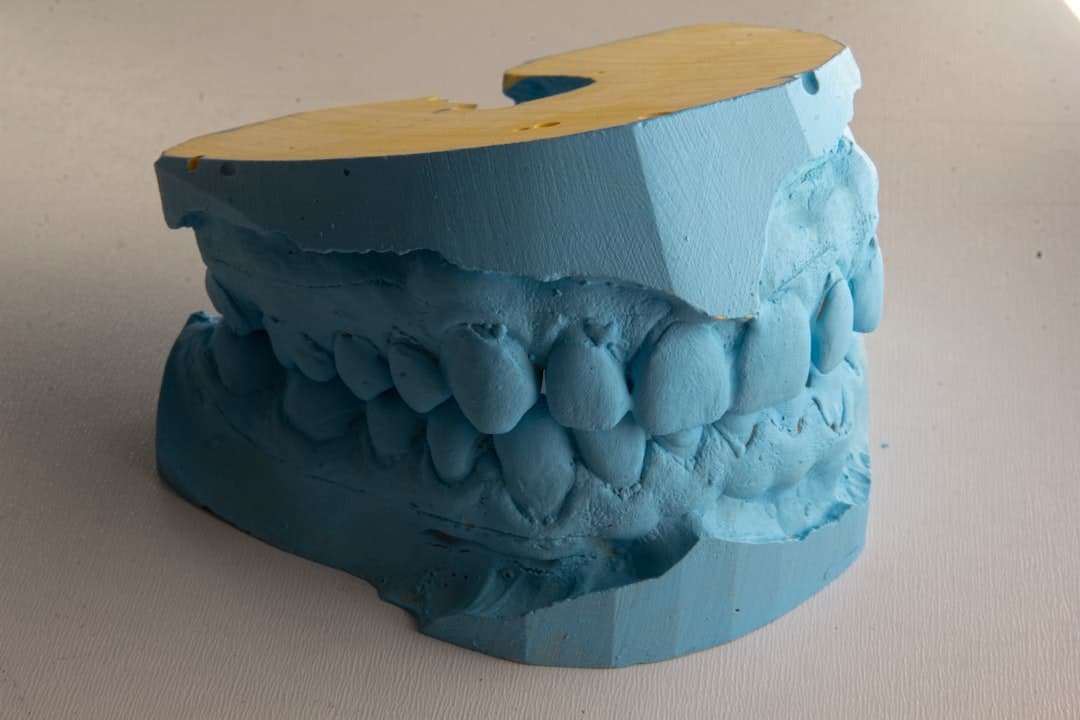 How Do Dental Implants Improve Jawbone Health and Oral Function Gillingham?