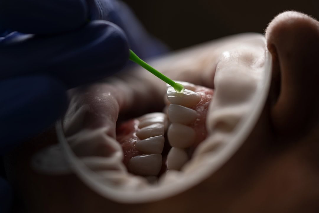 How Saliva Protects Your Teeth and Gums Gillingham