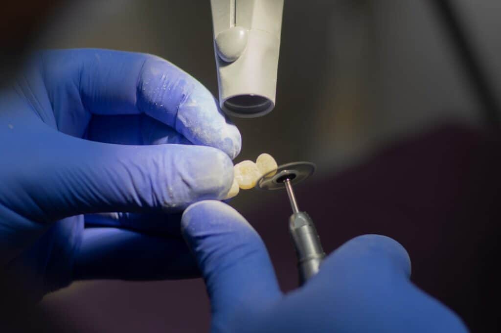 Customised Dental Solutions: Crowns, Aligners, and Implants Gillingham