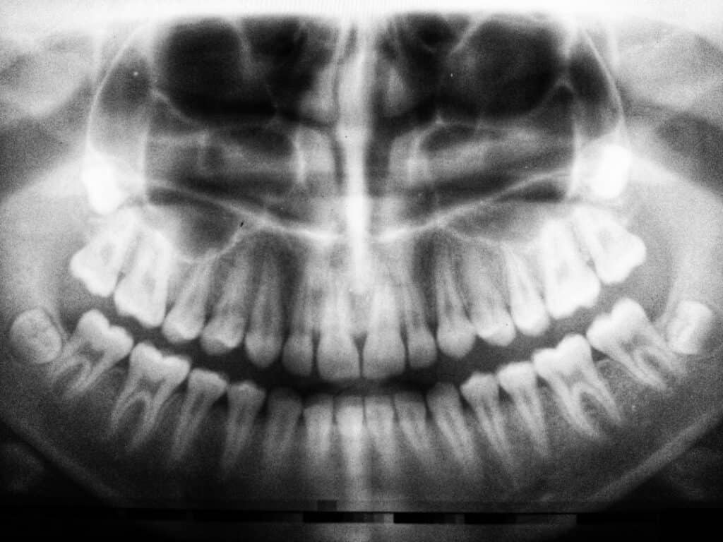 The Future of 3D Printing in Oral Healthcare Gillingham