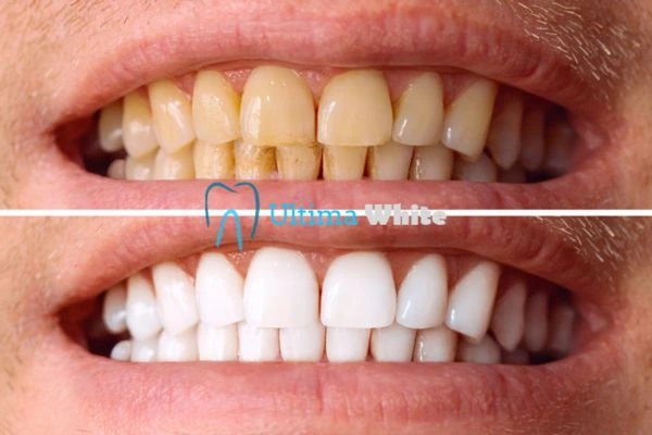 Stained Teeth and Persistent Bad Breath Gillingham